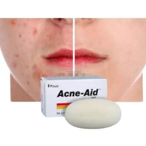 STIEFL Acne-Aid Bar -  Pimple Prone & Oily Skin(100gr) Acne Aid Shop. 