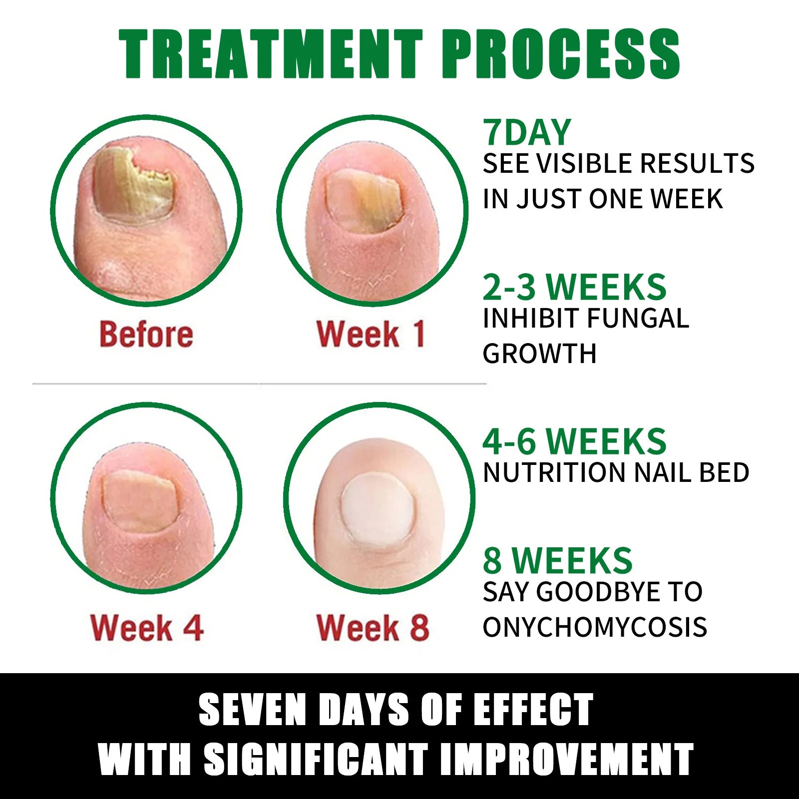 7DAYS Repair Nail Fungus Treatments Essence Foot Care Serum Toe Nails Fungal Removal Gel Anti-Infection Onychomycosis Care Tool. 