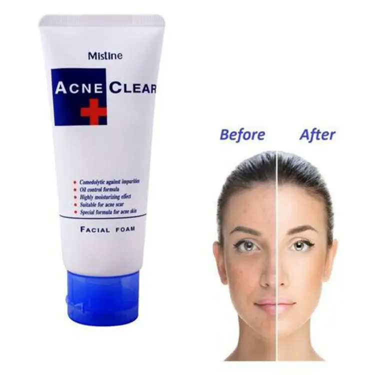 Mistine Acne Clear Facial Foam Face Wash 85Gm Made In