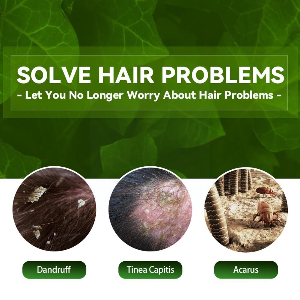 EELHOE 100ml Tinea Dispelling Anti-itching Shampoo Anti-dandruff Shampoo Hair Shampoo Treatment Oil Refreshing Control. 