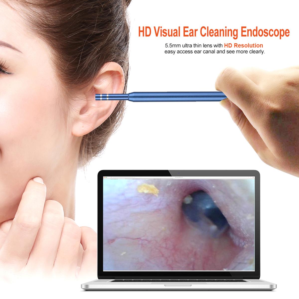mini camera for ear canal