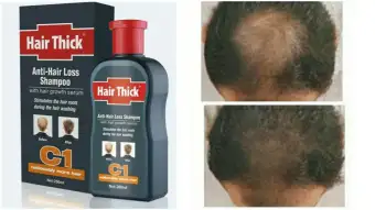 Hair Loss Products Hair Thick Dexe 200ml C1 Anti Hair Loss Shampoo